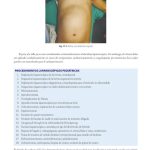 Anestesia en Cirugía Laparoscópica / Jayashree Sood  / Amolca