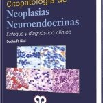 Citopatología de Neoplasias Neuroendocrinas  / Sudha Kini / Amolca