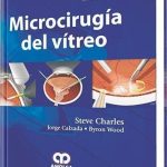Microcirugía del Vítreo / Steve Charles / Amolca