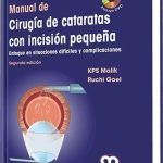 Manual de Cirugía de Cataratas con Incisión Pequeña / Amolca