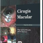 Cirugía Macular / Hugo Quiroz / Amolca