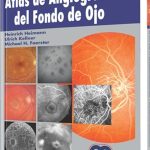 Atlas de Angiografía del Fondo de Ojo / Heinrich Heimann / Amolca