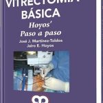 Vitrectomía Básica / José Martínez / Amolca