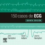 150 Casos de ECG / Hampton - Elsevier