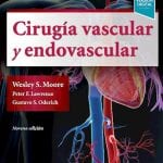 Cirugía Vascular y Endovascular / Moore - Elsevier