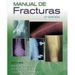 Manual de Fracturas  6 ED / Egol - Lippincott