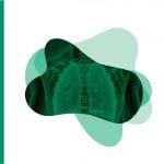 Neumología / Maíz - Panamericana