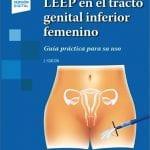 LEEP en el Tracto Genital Inferior Femenino / Gori - Panamericana