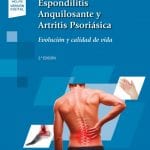 Espondilitis Anquilosante / Palmou - Panamericana