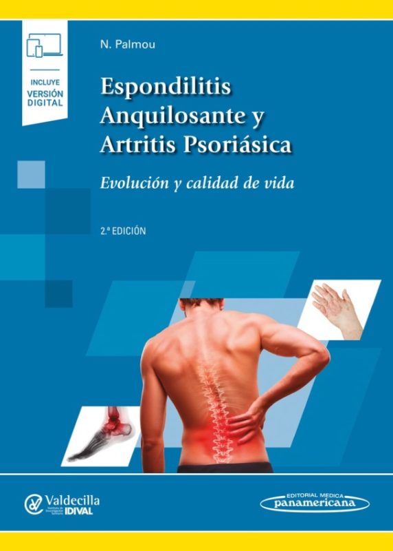 Espondilitis Anquilosante / Palmou - Panamericana